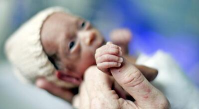 A tiny premature baby holds onto a thumb.